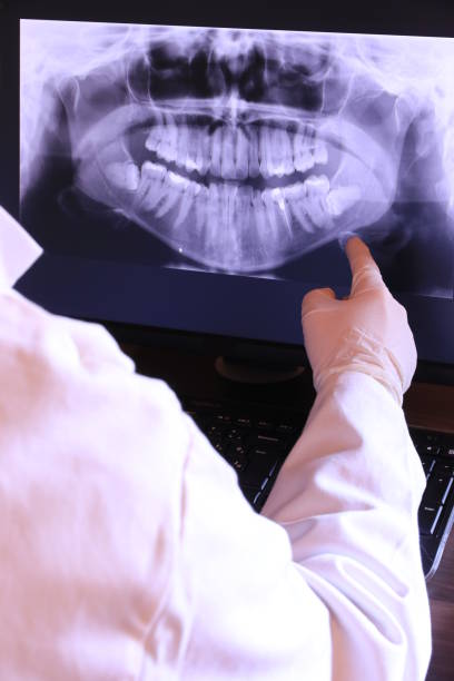 Best Emergency Tooth Extraction in Fisher, IL