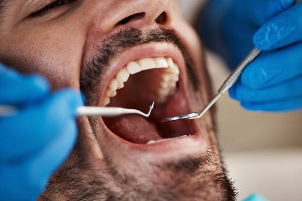 Best Urgent Dental Care in Fisher, IL
